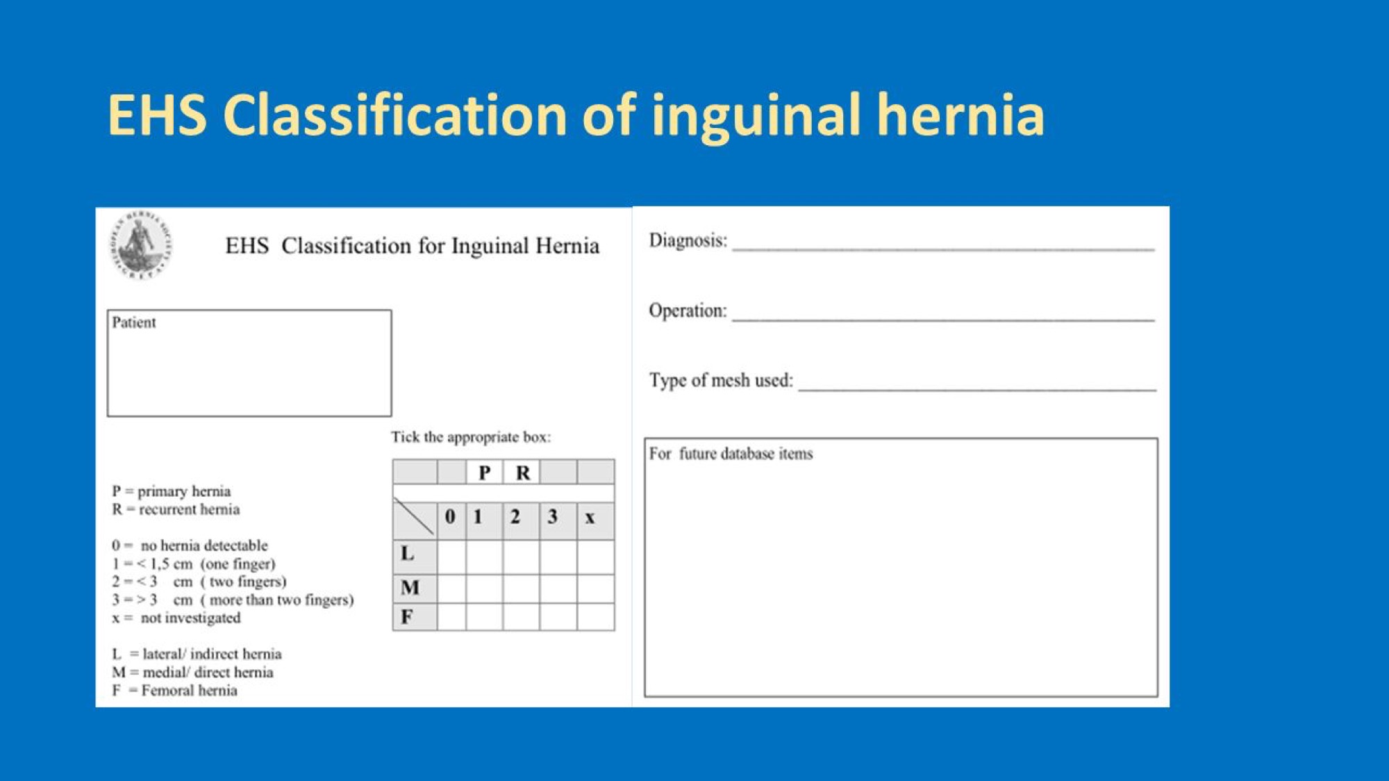 EHS+Classification+of+inguinal+hernia